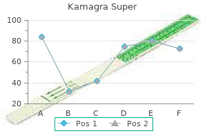 generic 160 mg kamagra super mastercard