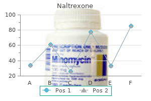 purchase naltrexone 50 mg line