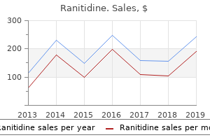 cheap ranitidine 150 mg overnight delivery