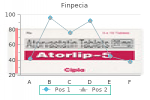 buy generic finpecia 1 mg on line